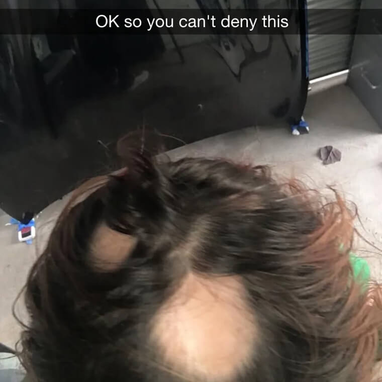 Shampoo Is For Cleaning Hair Not Make It Fall Out