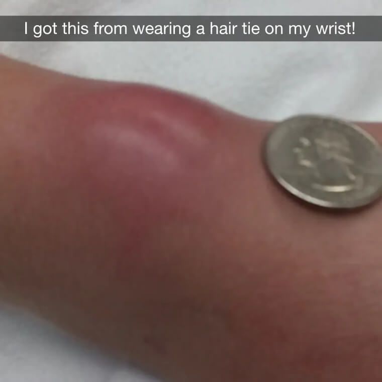 Why Hair Ties Only Belong In Hair