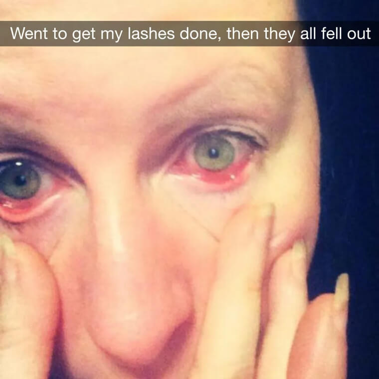 A New Meaning for Lashing Out