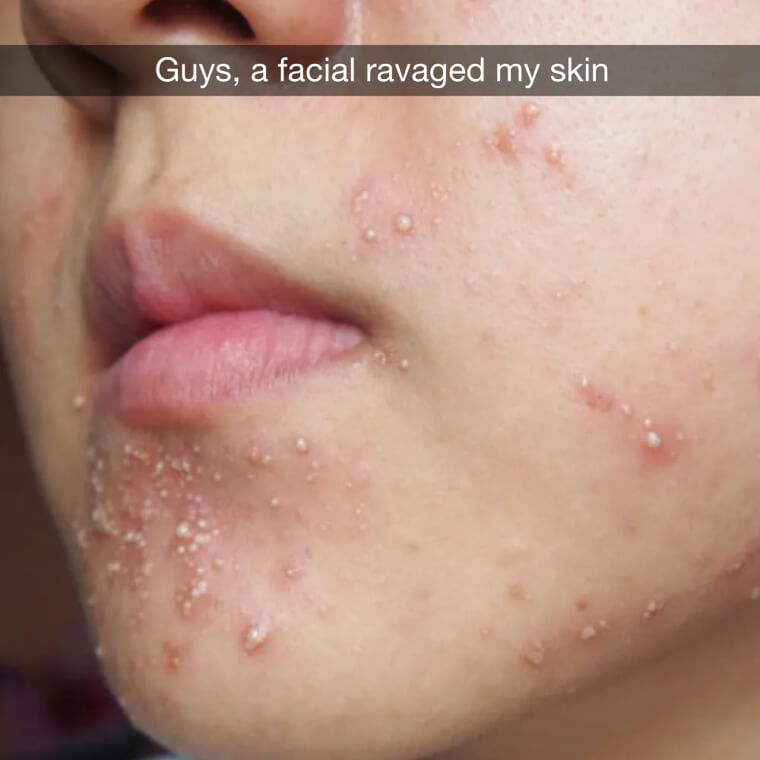 Unwelcome Results Of A Facial