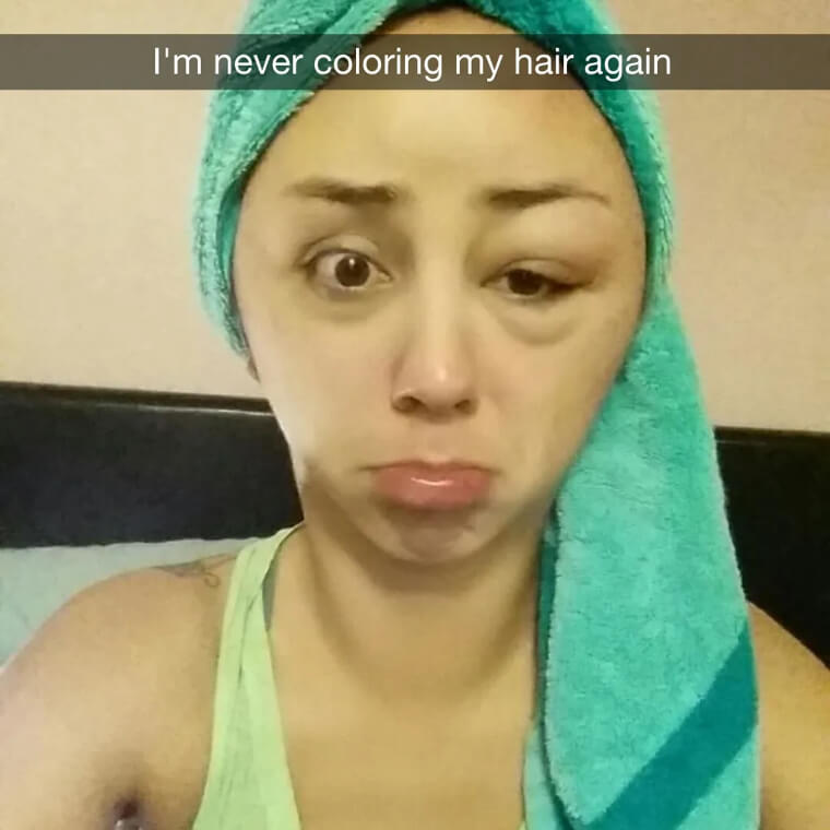 Surviving By A Hair