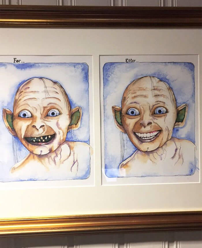 A Truly Appealing Before and After