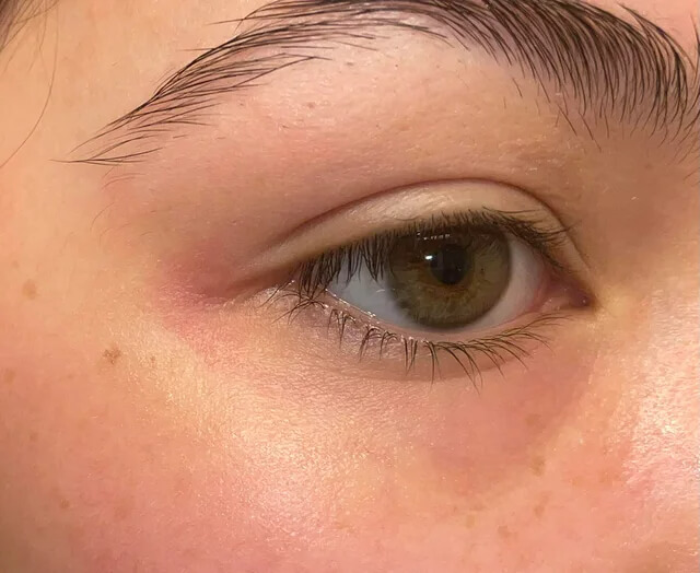 Esfregar constantemente os olhos pode causar rugas