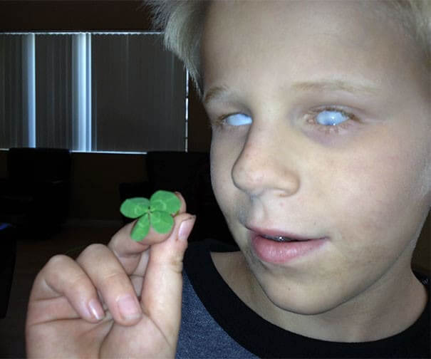His Blind Son Found A Four Leaf Clover