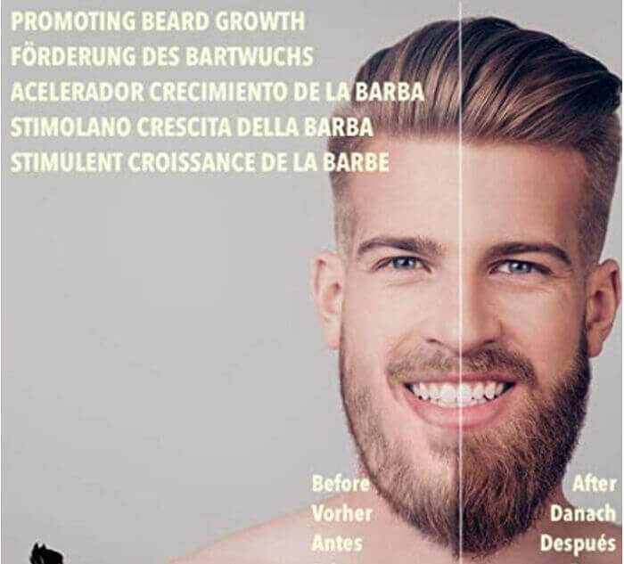 Since When Does A Man's Chin Look Like That?