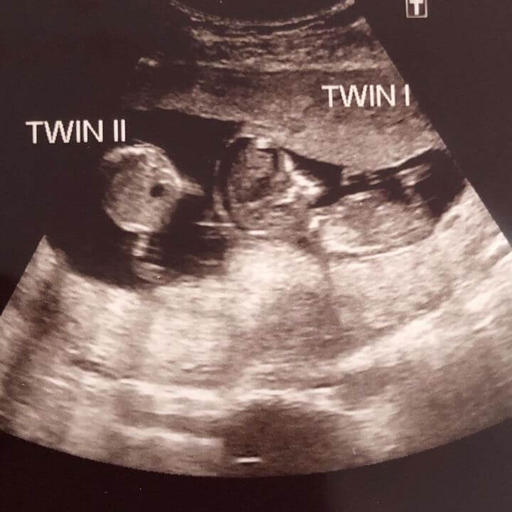 The "twins" Still Had a Dangerous Size Difference