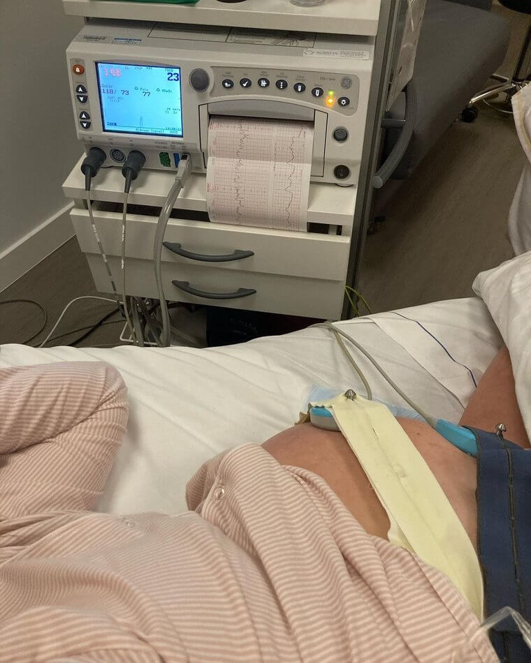 Umbilical Cord Trouble Forced Her to Go Into Labor Before the Planned Date