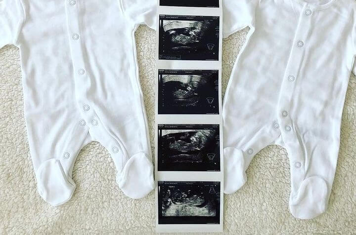 A Surprise Discovery