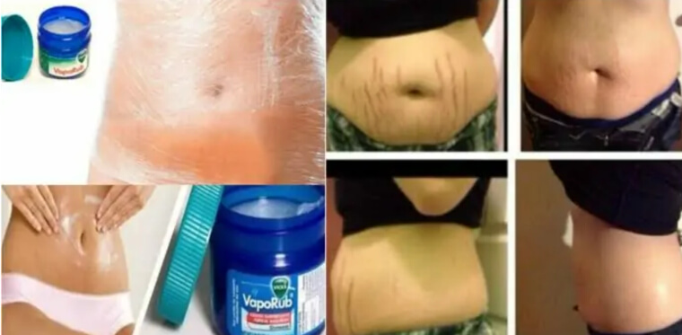 A Weight Loss Remedy