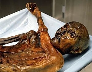 The Otzi Ice Man