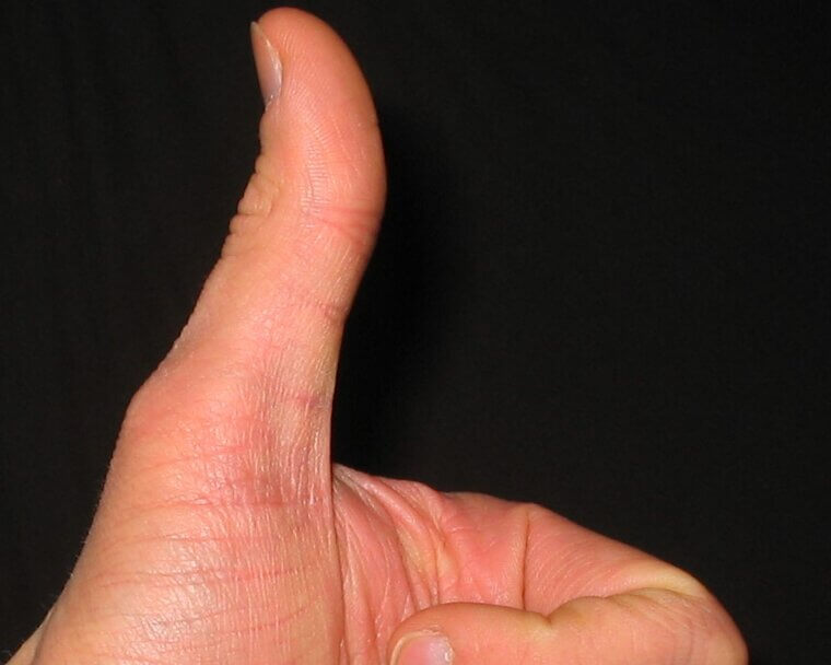 Giving a Thumbs up