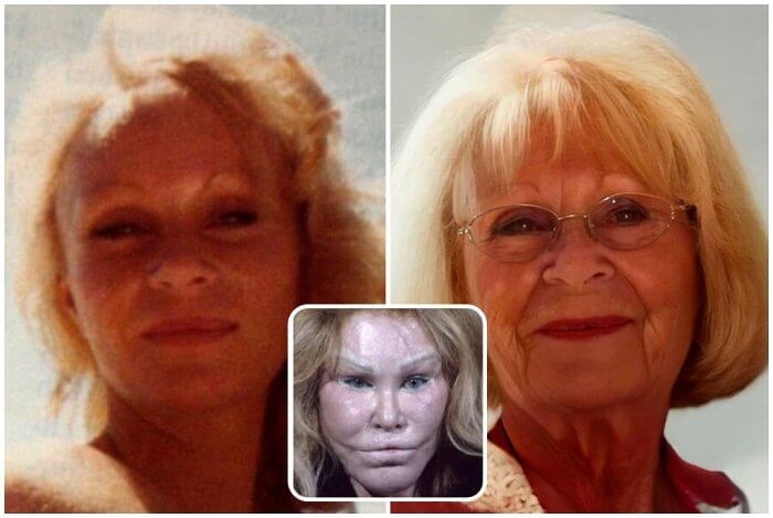 Jocelyn Wildenstein