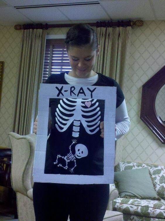 Before 3D Baby Videos There Were Low-Tech X-Ray Baby Scans