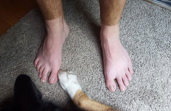 Matching Tan Lines With The Dog