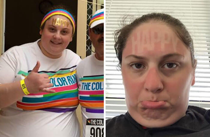 She Is Not "Happy" Now That It Is Tanned Onto Her Forehead