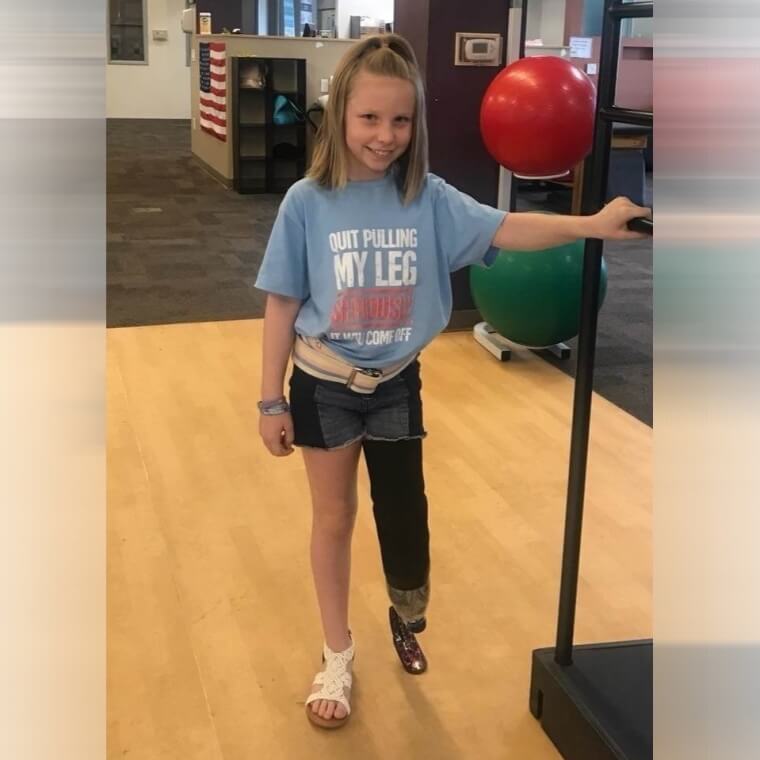 Physical Therapy For The New Leg