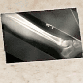 First Emergency Room Visit