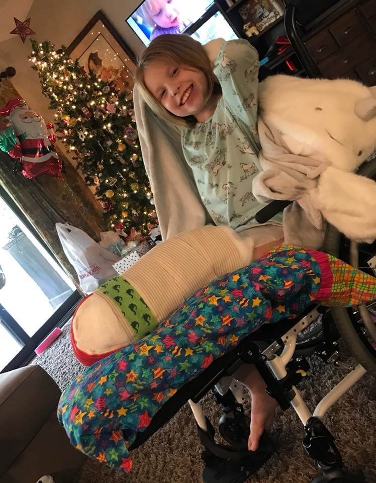 Stumpy Was Starting To Heal