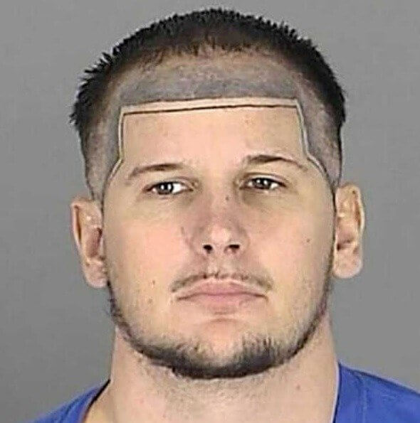 That's What We Call a Strong Hairline