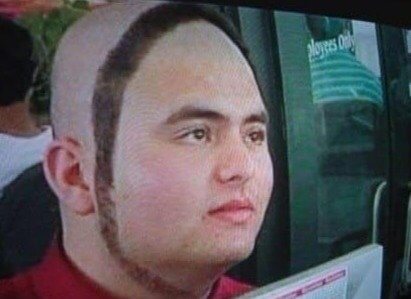 One Thing's for Sure: There's No Receding Hairline Here