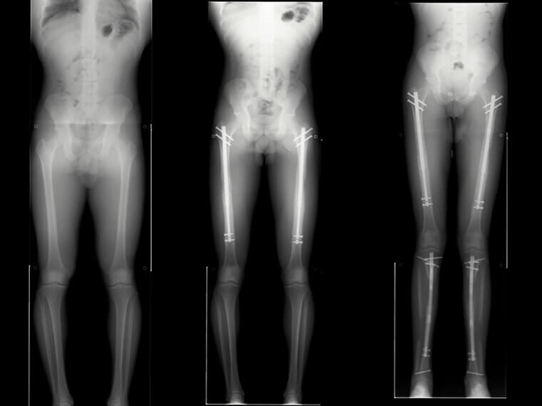 Seis pulgadas m谩s alto, pieza a pieza