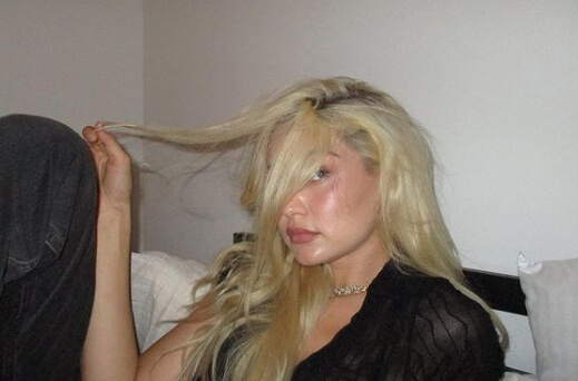 Gigi Hadid and Hashimoto's Disease