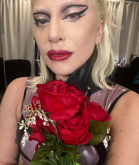 Lady Gaga and Fibromyalgia