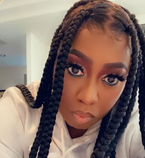 Missy Elliott and Graves’ Disease