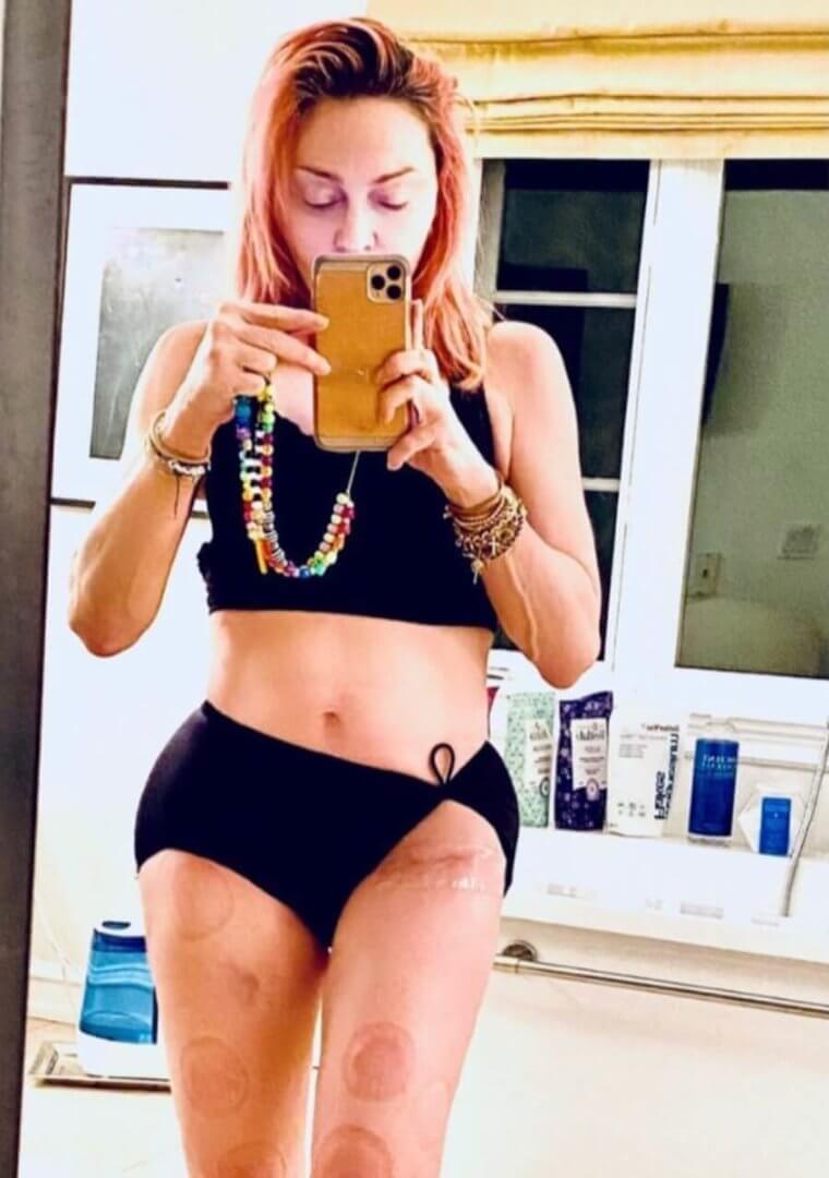 Madonna's Bruises Are For Her Beauty Routine