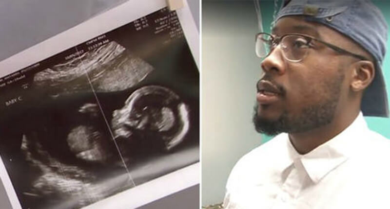 Father Of 3 Takes One Look At His Wife's Sonogram, And Immediately Faints When He Sees Something Unusual