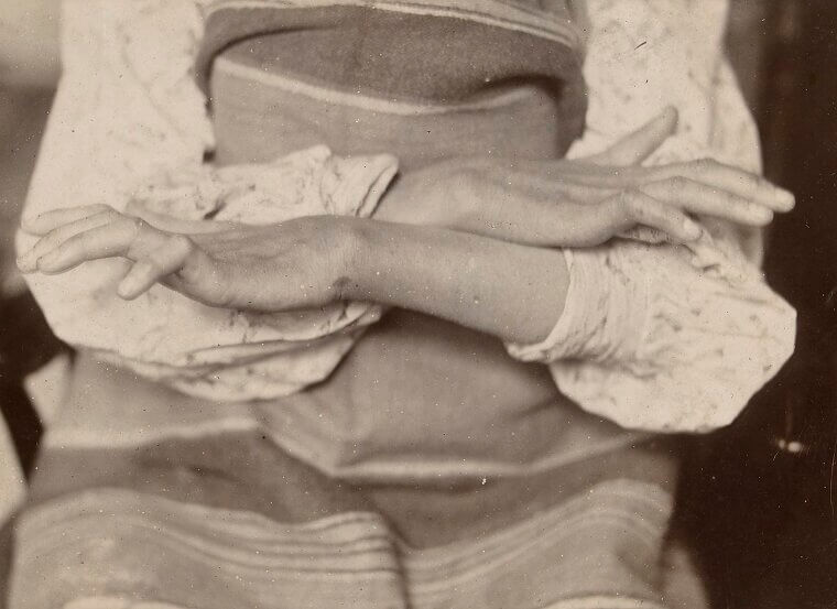 Stiff Joints, Anyone?