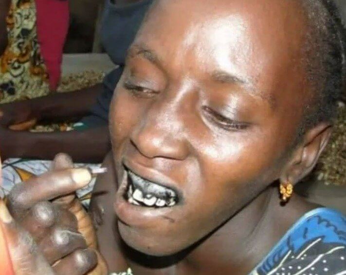 Татуиране на венците - Сенегал