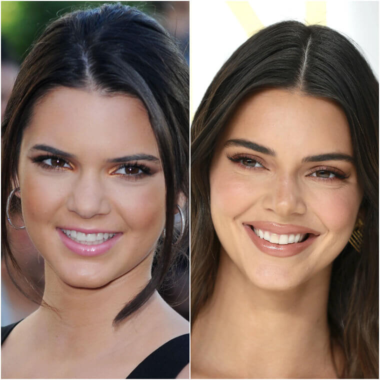 Kendall Jenner Looks Nothing Like Her Old Self