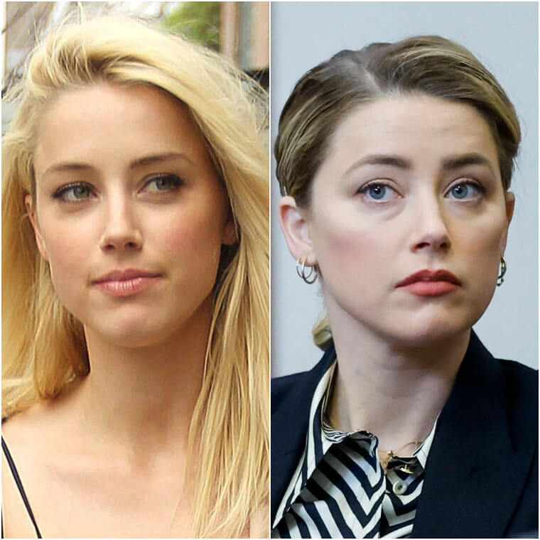 Amber Heard's Extensive List of Procedures