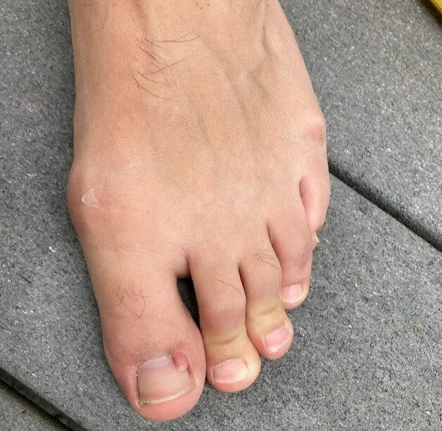 余分な足の指を見分けられる?ヒント:ミニチュア