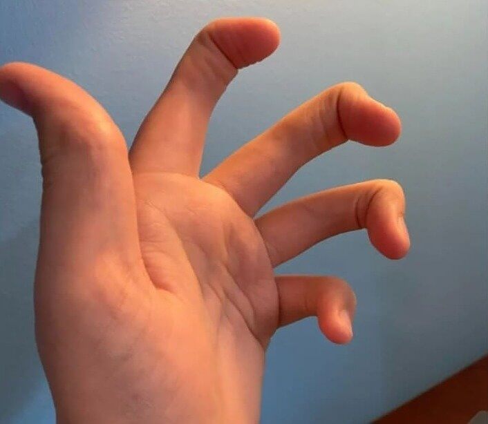 彼らの中指の関節がない