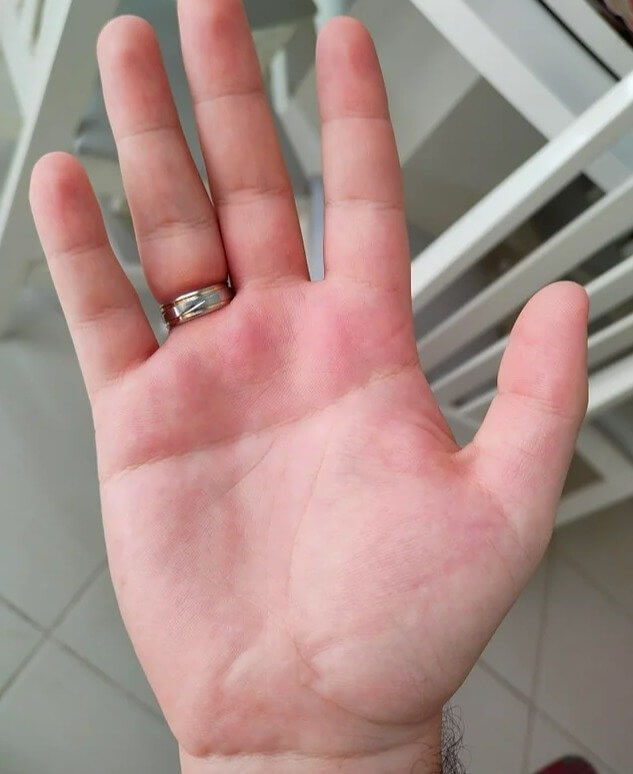 手のひらをまっすぐ横切る一本のシワ
