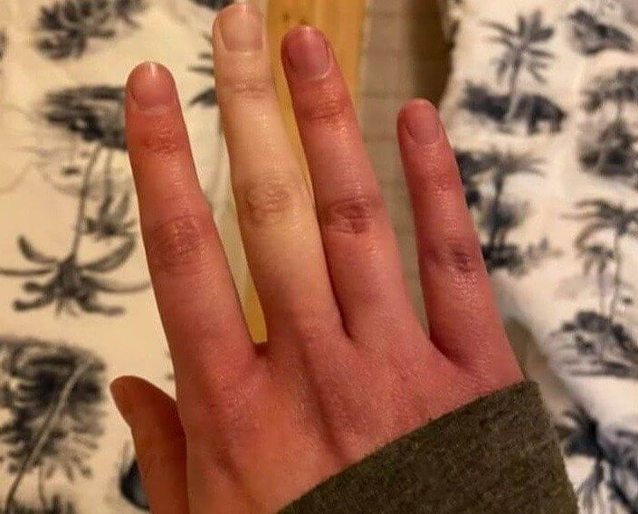 一本だけ見た目が違う指