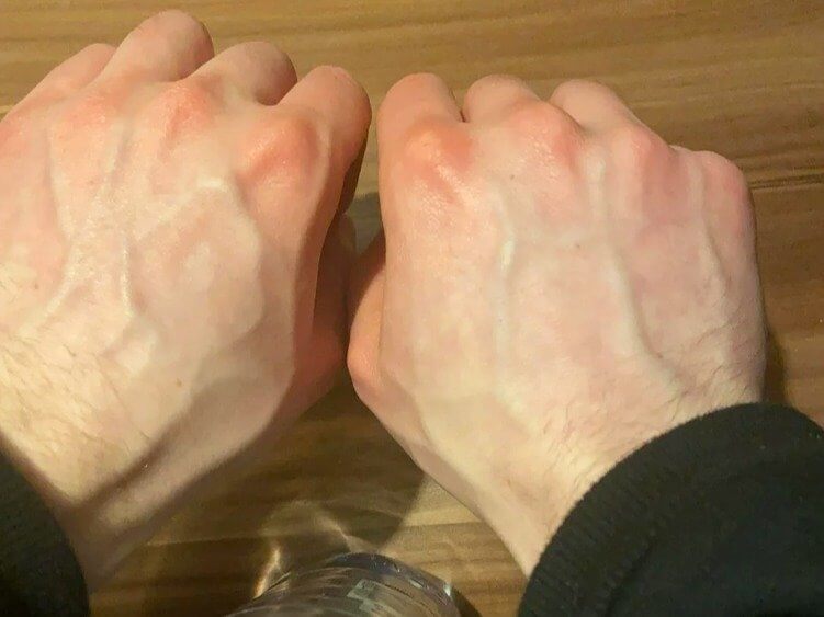 彼の血管は語るべきものがある - 文字通り