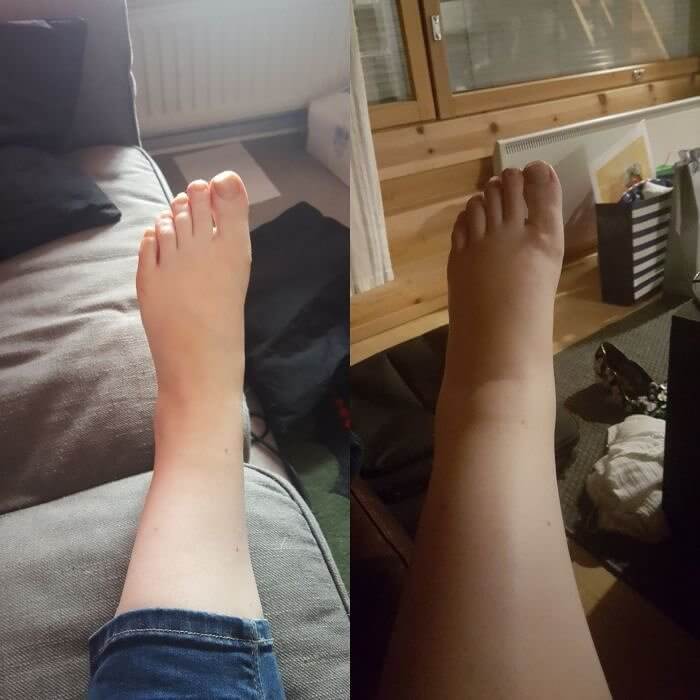 The Before Pictures Versus The During Pictures