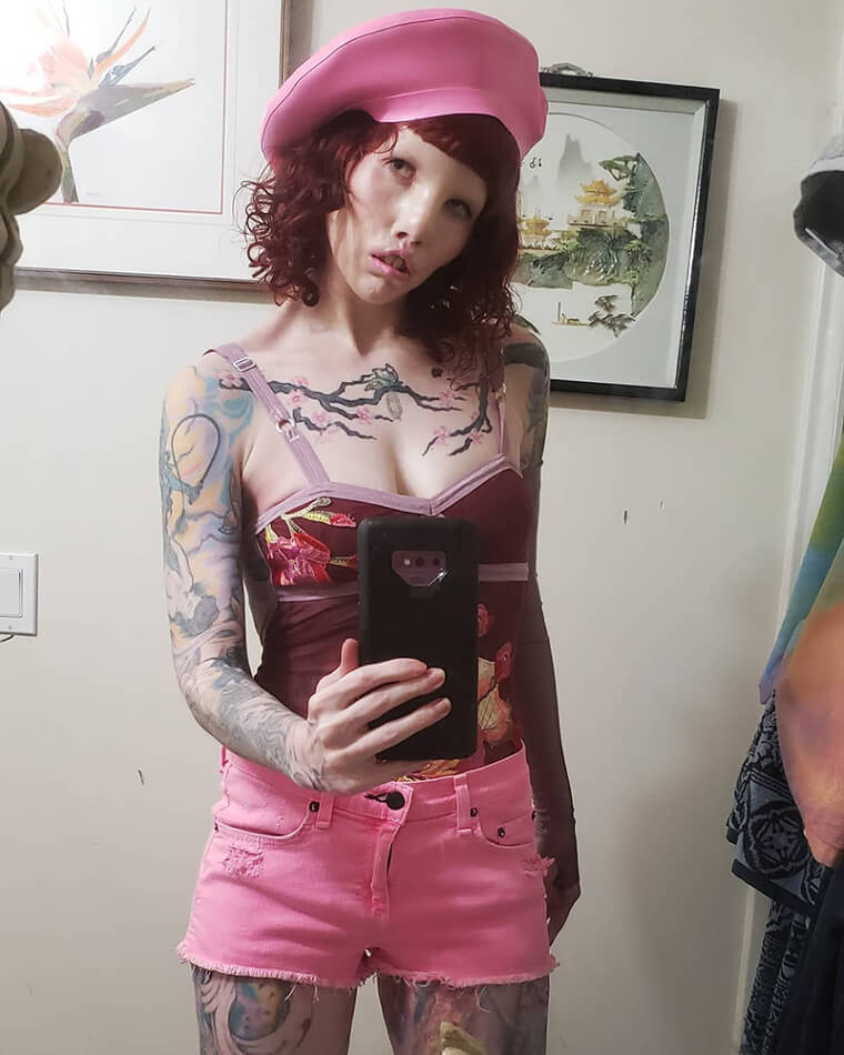Caitin Stickels Uses Her Cat Eye Syndrome to Model - and Create Art
