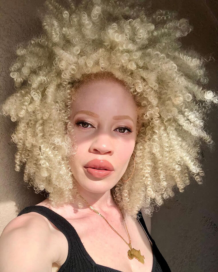 Diandra Forrest, Called 'Casper' as a Child, Became a Professional Model