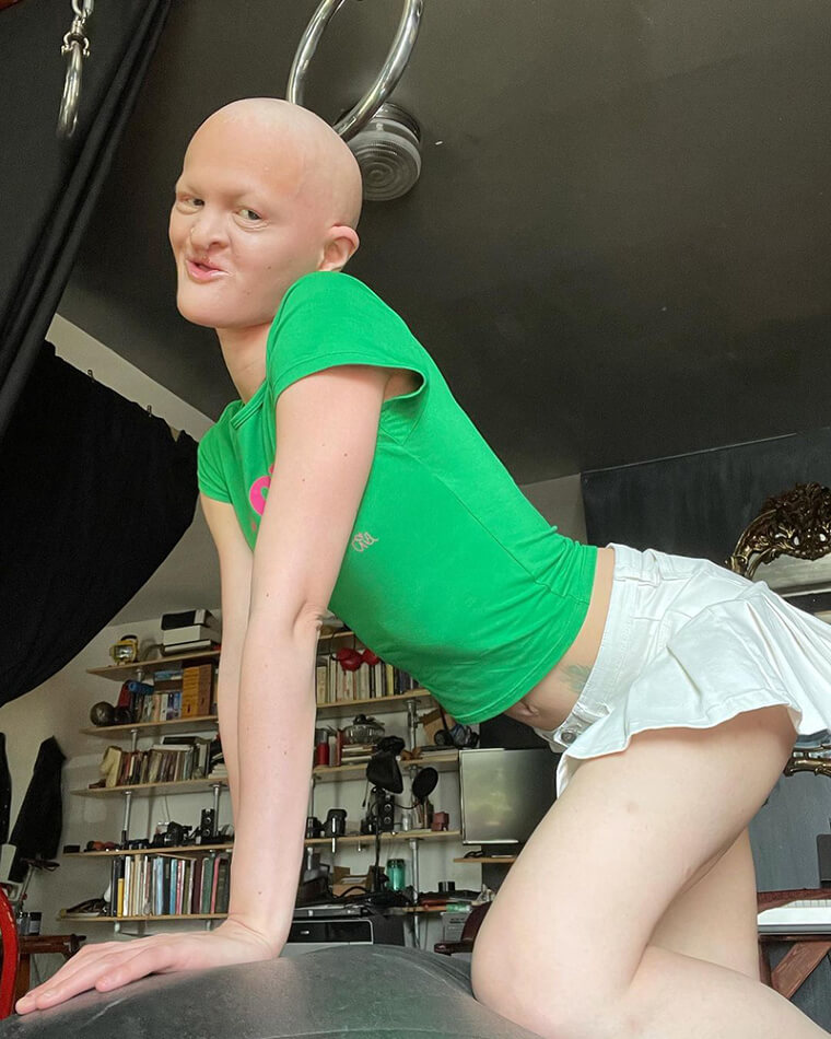 Melanie Gaydos Has No Hair, No Teeth - and a Punk Rock Attitude