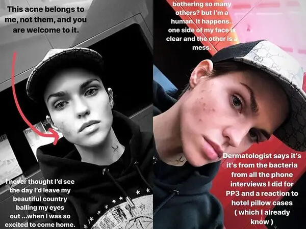 Ruby Rose Says We Are All Human