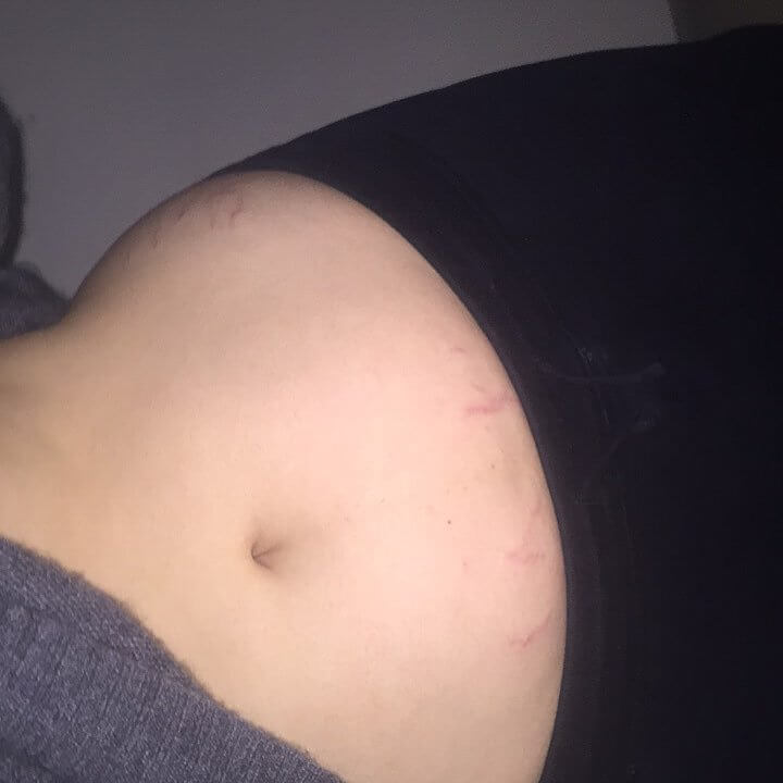 Barbie Ferreira Shows Off Her Stripes