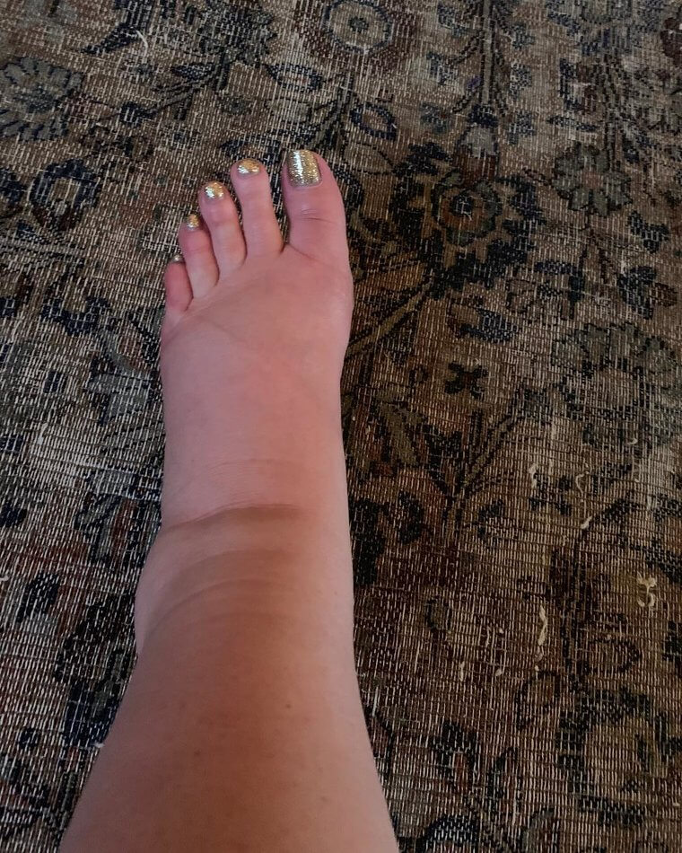 Jessica Simpson Shares Her Swollen Ankles