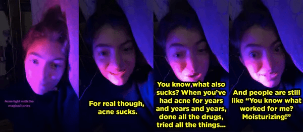 Lorde Talks About Acne Struggles