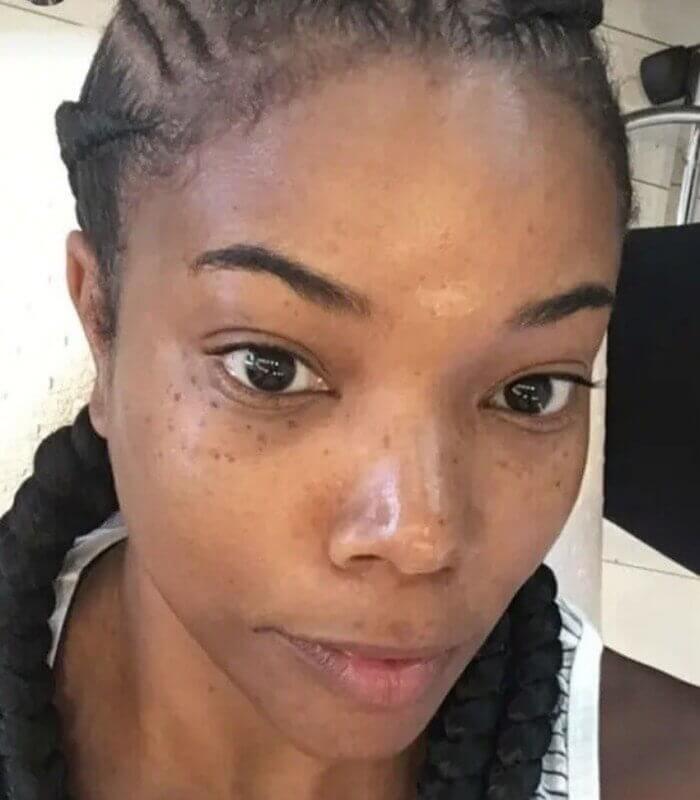 Gabrielle Union Loves Her Freckles
