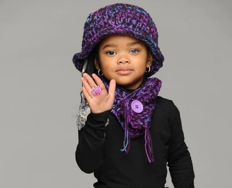 The Impact of The Condition on Morgan’s Modeling Career