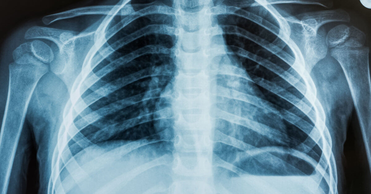 X-Rays That Took Doctors by Surprise